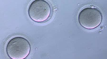 яйцеклетки