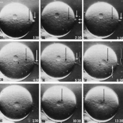 Embryoscope2_240x240