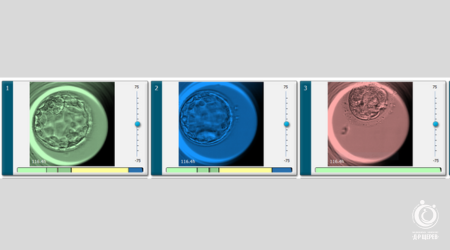 New_embryoscope_450x250