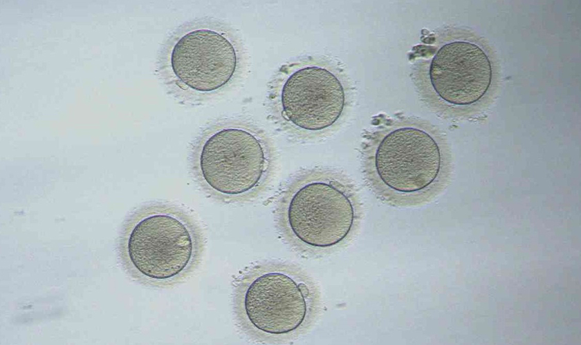 oocyte_new_lab oocyte_new_lab