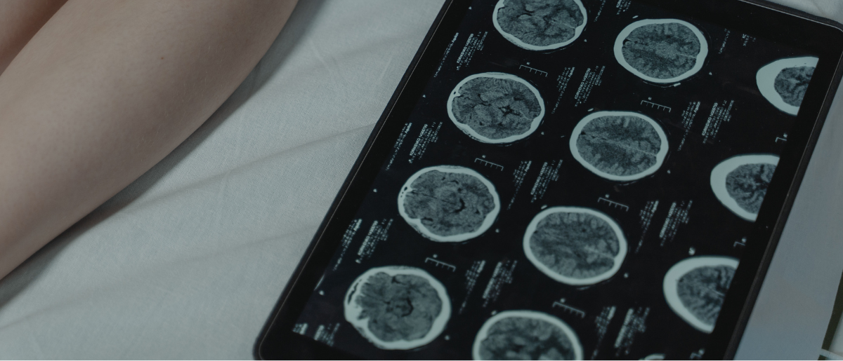 neurology1200x515